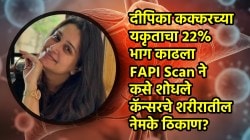 Dipika Kakar liver cancer: दीपिका कक्करच्या लिव्हरचा २२% भाग काढला; FAPI स्कॅनने कसे शोधले कॅन्सरचे ठिकाण?