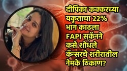 Dipika Kakar liver cancer: दीपिका कक्करच्या लिव्हरचा २२% भाग काढला; FAPI स्कॅनने कसे शोधले कॅन्सरचे ठिकाण?