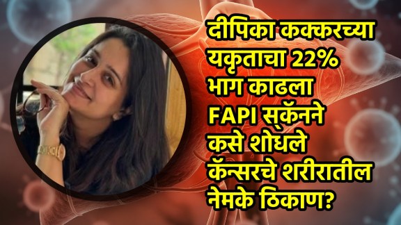 Dipika Kakar cancer story