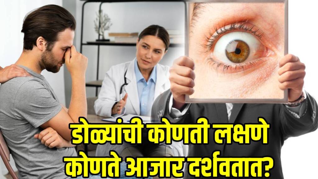 Eye-Can-Catch-Health-Problems