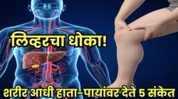 लिव्हर खराब व्हायला लागल्यास हाता-पायांवर दिसतात &#8216;ही&#8217; ५ लक्षणे, ९० टक्के लोक याकडे करतात दुर्लक्ष; त्वचेवरील &#8216;हे&#8217; बदल वेळीच ओळखा, नाहीतर..