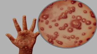 Clade 1 monkeypox in person returning from Saudi Arabia