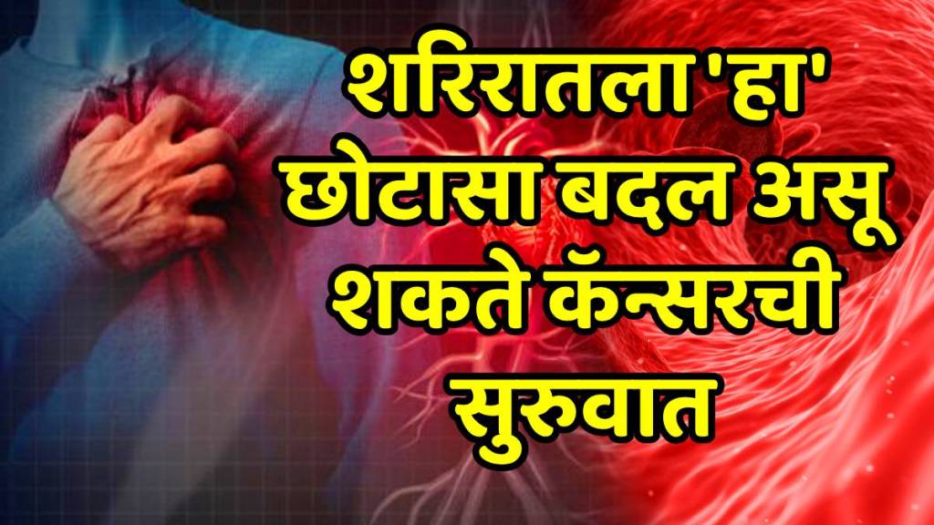 Cancer warning signs you should never ignore: Persistent mouth sores, fatigue or bleeding could be early red flags, says Raipur oncologist Cancer warning signs you should never ignore: Persistent mouth sores, fatigue or bleeding could be early red flags, says Raipur oncologist