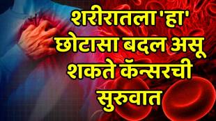 Cancer warning signs you should never ignore: Persistent mouth sores, fatigue or bleeding could be early red flags, says Raipur oncologist