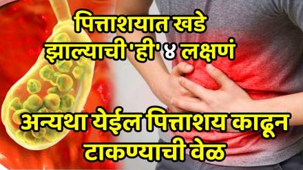 4 warning signs of gallstones you might be ignoring gallstones symptoms gallbladder stones increase 4 warning signs of gallstones you might be ignoring gallstones symptoms gallbladder stones increase