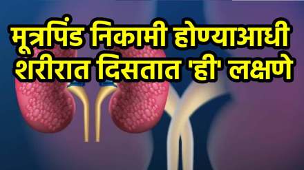 Kidney Damage Symptoms Kidney Damage Symptoms