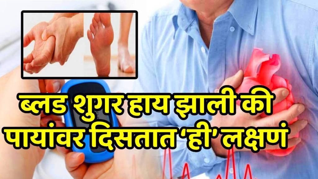 Gastro doctor, Dr Pal warns: 5 signs your blood sugar is out of control — even when your reports look 'normal' Gastro doctor, Dr Pal warns: 5 signs your blood sugar is out of control — even when your reports look 'normal'