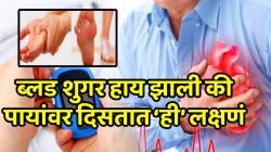 ब्लड शुगर हाय झाली की पायांवर दिसतात ‘ही’ लक्षणं; ‘या’ चुकांमुळेच ब्लड शुगर अचानक होते हाय, दुर्लक्ष न करता लगेच जाणून घ्या