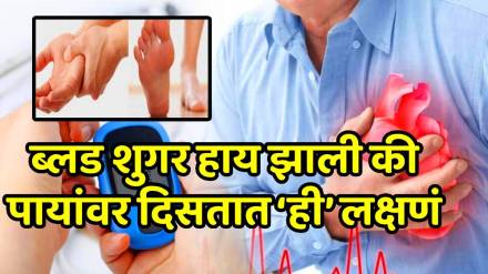 Gastro doctor, Dr Pal warns: 5 signs your blood sugar is out of control — even when your reports look 'normal'