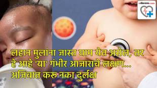 Excessive sweting chronic heart disease