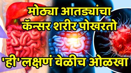 Colon cancer prevention