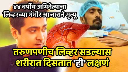 Tamil actor abhinay kinger dies at Age of 44 due to liver disease bad habits can damage liver by dr sarin