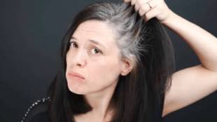 Young people with early grey hair problems reason