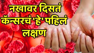 Nail abnormalities shape and color of nails tells secret about your health from diabetes cancer heart disease to thyroid