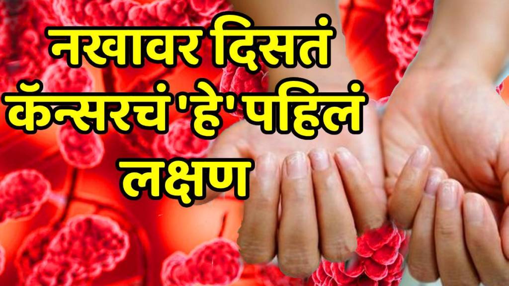 Nail abnormalities shape and color of nails tells secret about your health from diabetes cancer heart disease to thyroid Nail abnormalities shape and color of nails tells secret about your health from diabetes cancer heart disease to thyroid