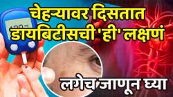Diabetes Symptoms: चेहऱ्यावर ‘ही’ लक्षणे दिसली तर समजून जा झालाय डायबिटीस, ब्लड शुगर वाढताच दिसतात या खुणा