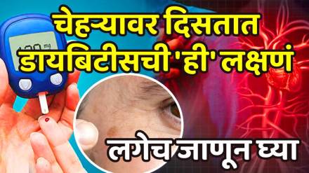 Your skin can reveal early signs of diabetes Your skin can reveal early signs of diabetes