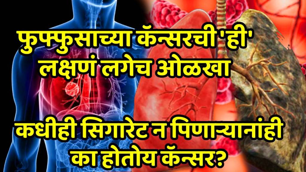 Lung Cancer Early Signs Symptoms Lung cancer isn’t just a smoker’s disease, say oncologists and warn on early signs this awareness month Lung Cancer Early Signs Symptoms Lung cancer isn’t just a smoker’s disease, say oncologists and warn on early signs this awareness month