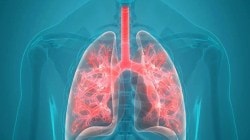 न्यूमोनियामुळे १६.३ टक्के बालमृत्यू; मृत्यू रोखण्यासाठी ‘सांस’….