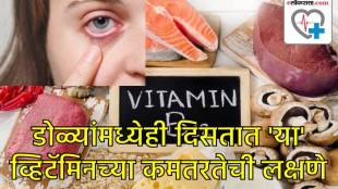 Vitamin B12 deficiency