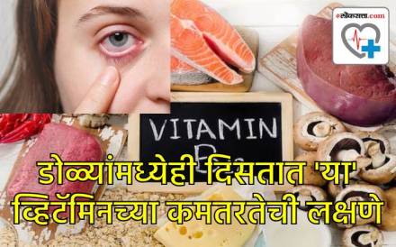 Vitamin B12 deficiency Vitamin B12 deficiency