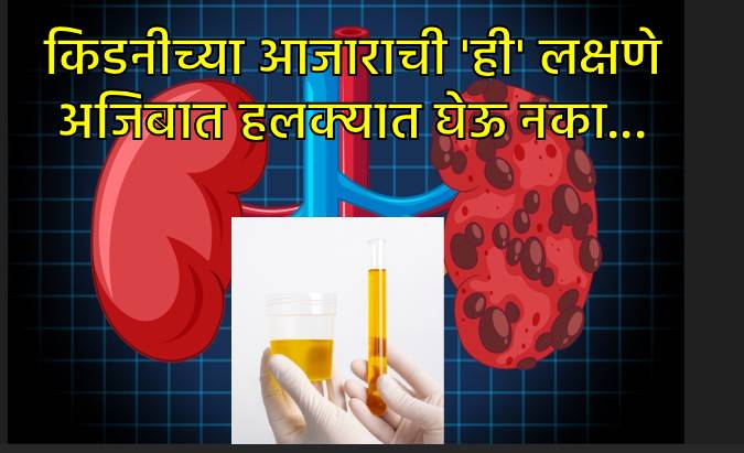 लघवीमध्ये दिसतात किडनीच्या आजाराची ही लक्षणे लघवीमध्ये दिसतात किडनीच्या आजाराची ही लक्षणे