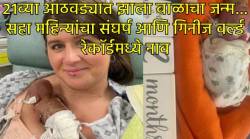 २१व्या आठवड्यात जन्माला येताच थेट गिनीज वर्ल्ड रेकॉर्डमध्ये नोंद… वजन होते अवघे २८३ ग्रॅम