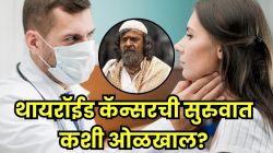 KGF मधील ‘काका’ हरीश राय यांचं कर्करोगानं निधन; ‘ही’ ८ लक्षणं दिसली तर लगेच तपासणी करा, असू शकते थायरॉईड कॅन्सरची सुरुवात!