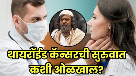 Thyroid cancer treatment Thyroid cancer treatment