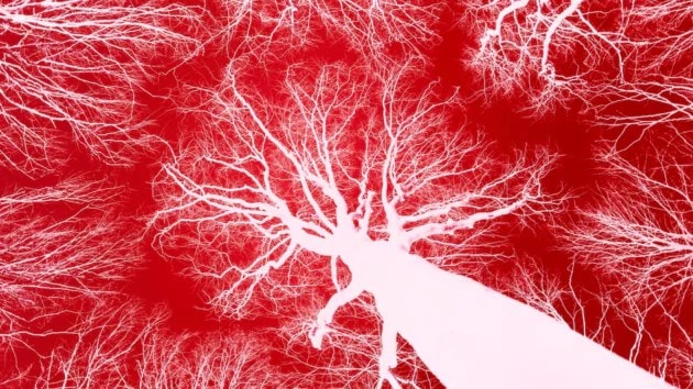 Walking improves brain health and helps control Alzheimer’s symptoms.