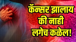 कॅन्सर झालाय की नाही लगेच कळेल! वयाच्या ‘या’ वर्षी ही टेस्ट कराच; दुर्लक्ष करणं पडेल महागात…