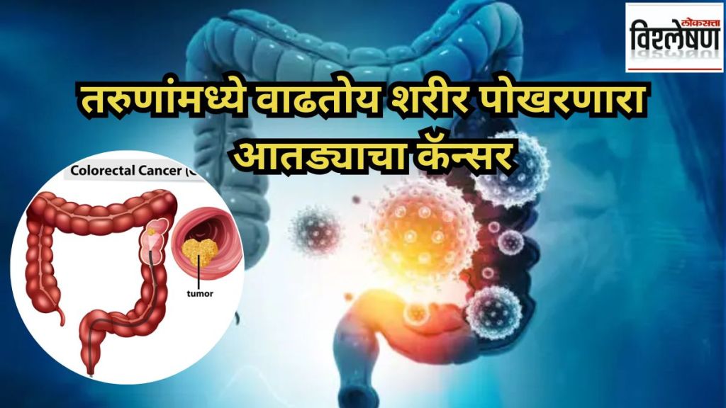 colorectal cancer rising in the young New study