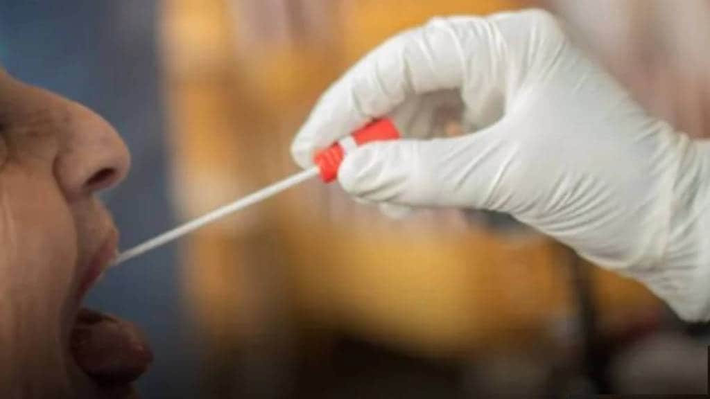 organ transplant covid test update