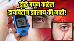 डोळे बघून कळेल डायबिटीज झालाय की नाही! ‘या’ ६ लक्षणांकडे दुर्लक्ष केलं तर होईल मोठं नुकसान…