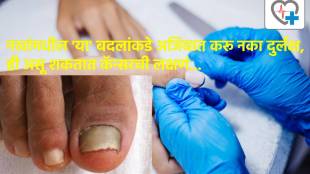 Cancer Symptoms on nails