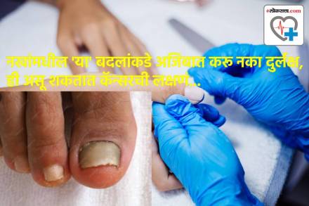 Cancer Symptoms on nails Cancer Symptoms on nails