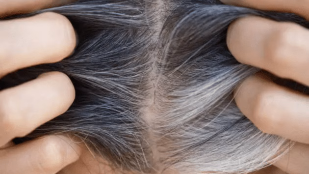 connection between grey hair and cancer