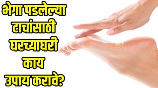 home-remedies-for-cracked-heels