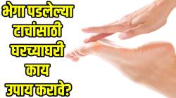 रात्री झोपण्याआधी ‘हा’ उपाय थंडीत तुमच्या टाचांना देईल आराम; भेगा होतील दूर अन् टाच राहील मऊ