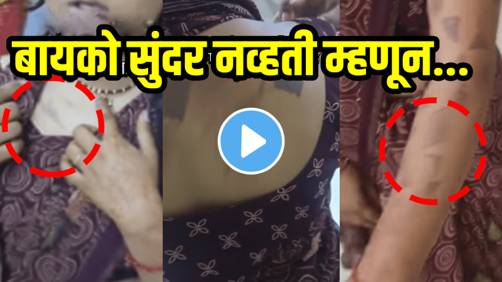 Husband burnt wife with knife coz she is not beautiful husband wife dispute shocking viral video on social media