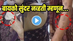 बायको सुंदर नव्हती म्हणून नवऱ्याने केलं धक्कादायक कृत्य! अंगावर ५० ठिकाणी चाकूने चटके दिले अन्…, VIDEO पाहून धक्का बसेल