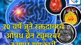 70-Year Old Blood Pressure Drug Hydralazine May Treat Aggressive Brain Tumors