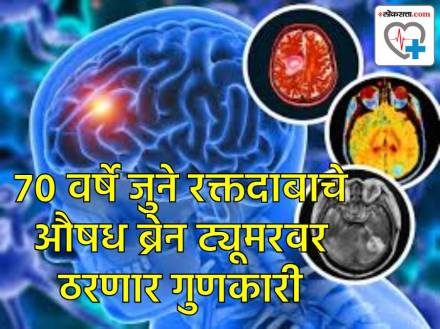 70-Year Old Blood Pressure Drug Hydralazine May Treat Aggressive Brain Tumors
