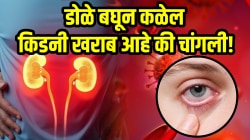 डोळे बघून कळेल किडनी खराब आहे की चांगली! ‘ही’ ५ लक्षणे दिसली तर चुकूनही दुर्लक्ष करू नका, नाहीतर जीवाचा धोका…