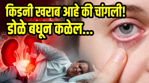 Kidney failure symptoms in eyes early signs of kidney fail kidney problems signs
