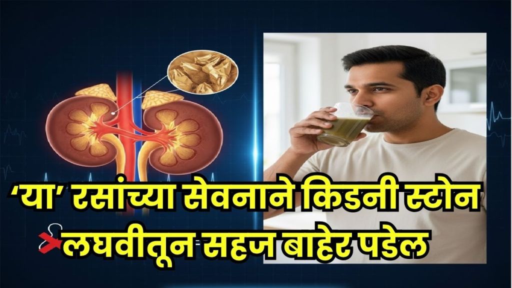 natural ways to remove kidney stones natural ways to remove kidney stones