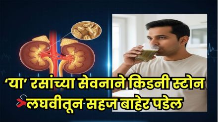natural ways to remove kidney stones