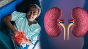 pune doctors perform rare robotic surgery on ectopic kidney