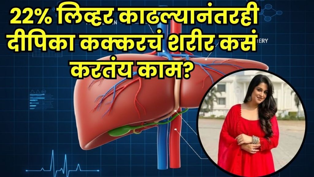 Deepika Kakkar liver surgery Deepika Kakkar liver surgery