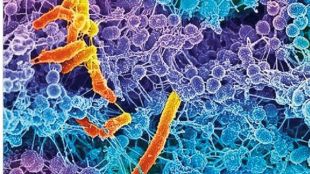 stanford scientists discover new rna life form in humans